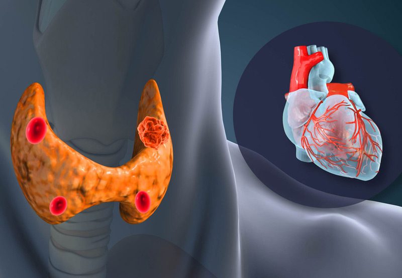 Illustration-of-hyperparathyroidism-effect-on-heart