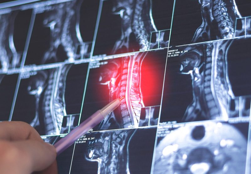 doctor-evaluating-neck-x-ray