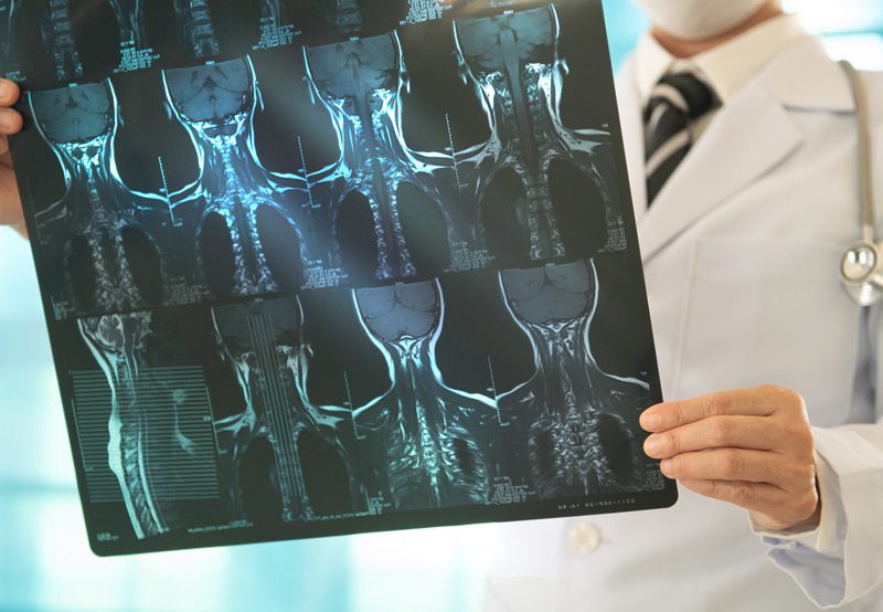 doctor-looking-at-x-ray-of-patient's-head-and-neck-area