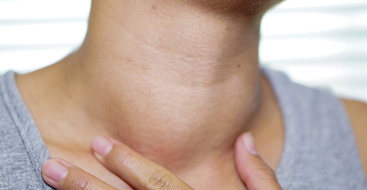 patient-with-enlarged-thyroid-gland